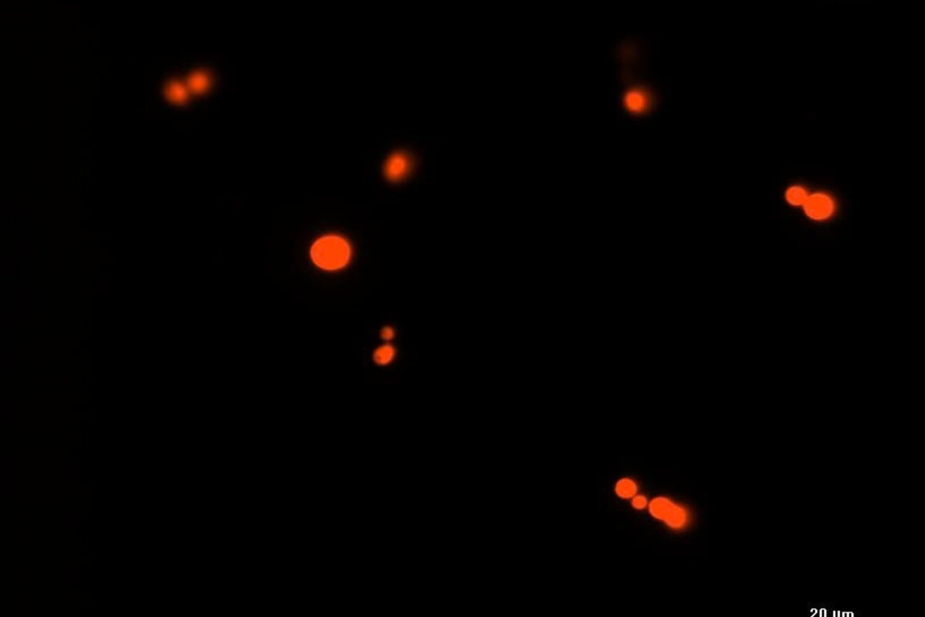 Microscopio observando cepas de levadura Saccharomyces cerevisiae en laboratorio de biotecnología